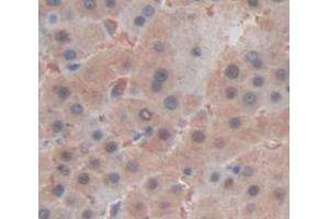 IHC-P analysis of Human Tissue, with DAB staining. (HSPB3 Antikörper  (AA 1-150))