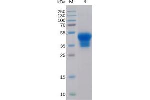 Human IL2RA Protein, His Tag on SDS-PAGE under reducing condition.