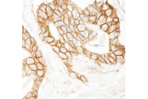 Immunohistochemistry (IHC) image for anti-Catenin, beta (CATNB) (AA 760-781) antibody (ABIN7454800) (beta Catenin Antikörper  (AA 760-781))