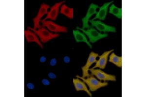 AQP2 Mouse Monoclonal Antibody staining HepG2 cells by IF/ICC. (AQP2 Antikörper  (C-Term))