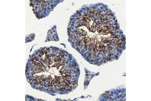 IHC analysis of SEC23IP using anti-SEC23IP antibody (ABIN7601222). (SEC23IP Antikörper  (AA 30-426))