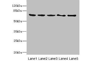 Western blot All lanes: PLK3 antibody at 1. (PLK3 Antikörper  (AA 487-646))