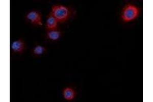 Immunofluorescent analysis of Syntaxin 1A (pS14) staining in NIH3T3 cells. (STX1A Antikörper  (N-Term, pSer14))