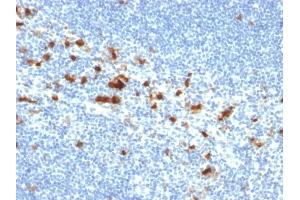 Immunohistochemistry (IHC) image for anti-Integrin, alpha E (Antigen CD103, Human Mucosal Lymphocyte Antigen 1, alpha Polypeptide) (ITGAE) antibody (ABIN6939807)