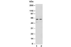 Western blot testing of NOX1 antibody and Lane 1:  HeLa (NOX1 Antikörper  (AA 354-374))