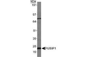 Western blot analysis of FUSIP1, isoform 3, in HepG2 whole cell lysates using FUSIP1 polyclonal antibody . (SRSF10 Antikörper  (AA 100-200))