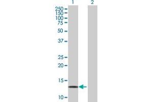 Western Blot analysis of LDOC1 expression in transfected 293T cell line by LDOC1 MaxPab polyclonal antibody. (LDOC1 Antikörper  (AA 1-146))