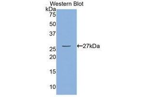 Western Blotting (WB) image for anti-Myosin Light Chain Kinase (MYLK) (AA 1661-1877) antibody (ABIN1859947)
