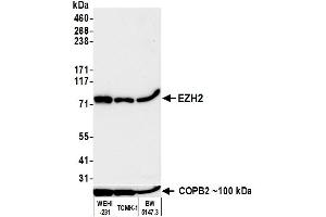 Western Blotting (WB) image for anti-Enhancer of Zeste Homolog 2 (EZH2) (C-Term) antibody (ABIN7795723) (Rekombinanter EZH2 Antikörper  (C-Term))