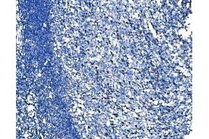 IHC analysis of HSPA6 using anti-HSPA6 antibody (ABIN7601944). (HSPA6 Antikörper  (AA 516-643))