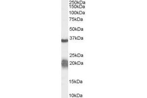 Western Blotting (WB) image for anti-Arginase, Liver (ARG1) (AA 316-330) antibody (ABIN295463)