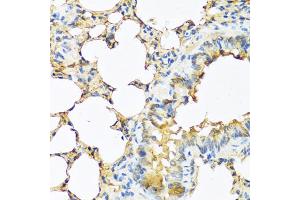 Immunohistochemistry of paraffin-embedded mouse lung using TSHB antibody (ABIN5974108) at dilution of 1/100 (40x lens).