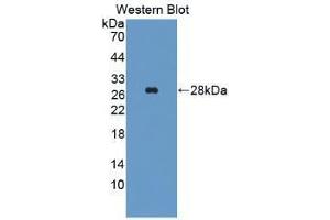 Western blot analysis of recombinant Human ALT. (ALT Antikörper  (AA 255-496))