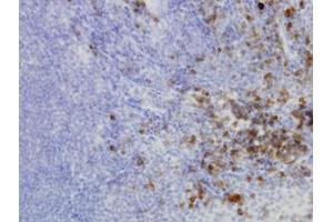 Image no. 1 for anti-Homocysteine-Inducible, Endoplasmic Reticulum Stress-Inducible, Ubiquitin-Like Domain Member 1 (HERPUD1) (AA 74-181) antibody (ABIN466153) (HERPUD1 Antikörper  (AA 74-181))