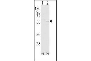 Image no. 1 for anti-Vimentin (VIM) antibody (ABIN357886) (Vimentin Antikörper)