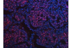 IF analysis of SCML1 using anti-SCML1 antibody (ABIN7602479).