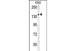Western Blotting (WB) image for anti-Solute Carrier Family 12 (Potassium-Chloride Transporter) Member 5 (SLC12A5) (AA 5-33), (N-Term) antibody (ABIN652057)