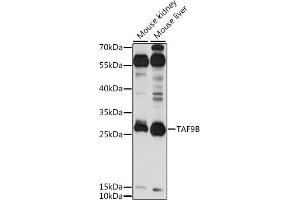 Western blot analysis of extracts of various cell lines, using TB antibody (ABIN7270718) at 1:1000 dilution.