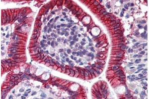 Human Small Intestine: Formalin-Fixed, Paraffin-Embedded (FFPE) (LI Cadherin Antikörper  (AA 24-132))