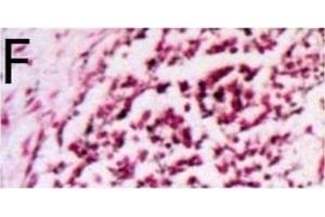 Immunohistochemistry (Paraffin-embedded Sections) (IHC (p)) image for anti-Microphthalmia-Associated Transcription Factor (MITF) (AA 351-450) antibody (ABIN676373)