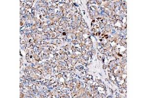 IHC analysis of Paxillin/PXN using anti-Paxillin/PXN antibody (ABIN7602636). (Paxillin Antikörper  (AA 9-570))