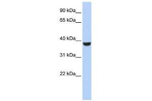 PPP1CA antibody used at 1 ug/ml to detect target protein.
