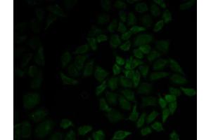Immunofluorescence analysis of HeLa cells using MSN antibody. (Moesin Antikörper  (AA 1-300))