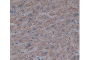 Immunohistochemistry (IHC) image for anti-Procollagen III N-Terminal Propeptide (PIIINP) (AA 24-153) antibody (ABIN1173222)