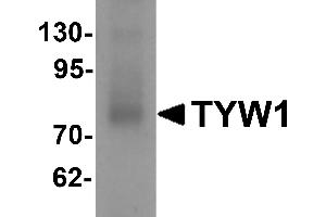Western blot analysis of TYW1 in human lung tissue lysate with TYW1 antibody at 1 µg/mL. (TYW1 Antikörper  (C-Term))