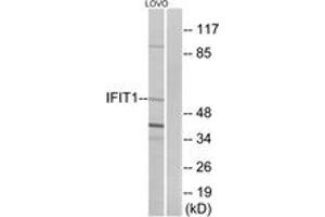 Western Blotting (WB) image for anti-Interferon-Induced Protein with Tetratricopeptide Repeats 1 (IFIT1) (AA 41-90) antibody (ABIN2889970) (IFIT1 Antikörper  (AA 41-90))