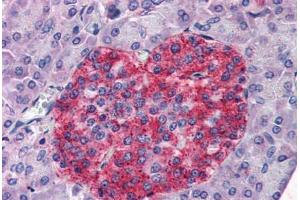 Human Pancreas (formalin-fixed, paraffin-embedded) stained with ANXA10 antibody ABIN351461 at 3. (Annexin a10 Antikörper  (AA 2-16))