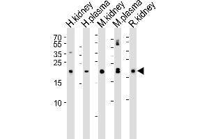 Western Blotting (WB) image for anti-Glutathione Peroxidase 3 (Plasma) (GPX3) (AA 93-123) antibody (ABIN650617)
