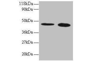 Western blot All lanes: TTC1 antibody at 2 μg/mL Lane 1: 293T whole cell lysate Lane 2: EC109 whole cell lysate Secondary Goat polyclonal to rabbit IgG at 1/15000 dilution Predicted band size: 34 kDa Observed band size: 45 kDa (TTC1 Antikörper  (AA 3-292))