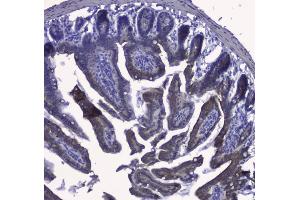 IHC analysis of Cytokeratin 19 using anti-Cytokeratin 19 antibody (ABIN3043288).