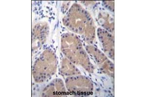 CA1 Antibody immunohistochemistry analysis in formalin fixed and paraffin embedded human stomach tissue followed by peroxidase conjugation of the secondary antibody and DAB staining. (CA1 Antikörper  (N-Term))