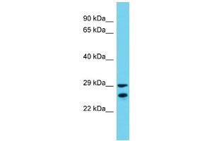 Host: Rabbit  Target Name: Zar1l  Sample Tissue: Mouse Testis lysates  Antibody Dilution: 1. (ZAR1L Antikörper  (C-Term))