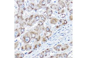 Immunohistochemistry of paraffin-embedded human liver using AGXT Rabbit pAb  at dilution of 1:150 (40x lens). (AGXT Antikörper  (AA 183-392))