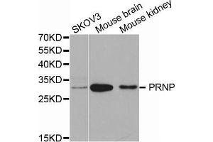 Western blot analysis of extracts of various cell lines, using PRNP antibody. (PRNP Antikörper  (AA 23-230))