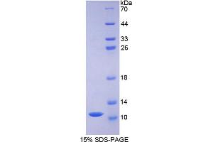SDS-PAGE analysis of Pig Defensin beta 1 Protein.