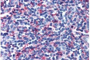 Anti-GPR44 / CRTH2 antibody  ABIN1048826 IHC staining of human tonsil. (Prostaglandin D2 Receptor 2 (PTGDR2) (Extracellular Domain) Antikörper)