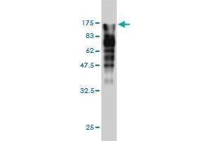 Western Blot detection against Immunogen (123. (MVP Antikörper  (AA 1-893))