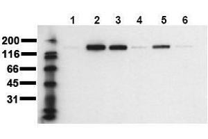 Western Blotting (WB) image for anti-Receptor tyrosine-protein kinase erbB-2 (ErbB2/Her2) (pThr686) antibody (ABIN126787) (ErbB2/Her2 Antikörper  (pThr686))