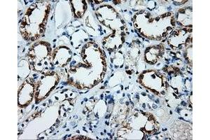 Immunohistochemical staining of paraffin-embedded Kidney tissue using anti-PLEK mouse monoclonal antibody. (Pleckstrin Antikörper)
