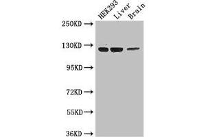 Western Blot Positive WB detected in: HEK293 whole cell lysate, Mouse liver tissue, Mouse brain tissue All lanes: GUCY2C antibody at 3. (GUCY2C Antikörper  (AA 636-891))