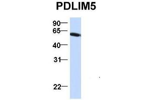 Western Blotting (WB) image for anti-PDZ and LIM Domain 5 (PDLIM5) (N-Term) antibody (ABIN2780775)