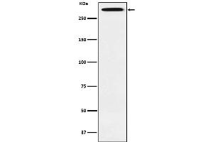 Western blot analysis of Smg1 expression in Saos2 cell lysate.
