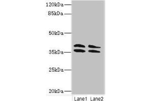 Western blot All lanes: CA10 antibody at 4 μg/mL Lane 1: HL60 whole cell lysate Lane 2: Mouse brain tissue Secondary Goat polyclonal to rabbit IgG at 1/10000 dilution Predicted band size: 38, 30 kDa Observed band size: 38 kDa (CA1 Antikörper  (AA 61-320))
