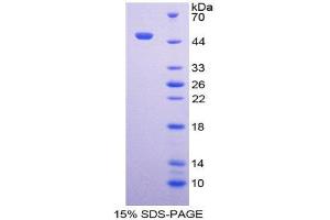 SDS-PAGE (SDS) image for Neuroglobin (NGB) (AA 1-151) protein (His tag,GST tag) (ABIN1980790)