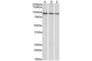 AP21267PU-N ACO2 Antibody staining of Mouse (A), Rat (B) and Pig (C) Skeletal Muscle lysates at 0. (ACO2 Antikörper  (Internal Region))