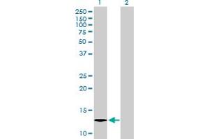 Western Blot analysis of C1orf38 expression in transfected 293T cell line by C1orf38 MaxPab polyclonal antibody.